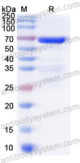 佰乐博生物蛋白抗体 —— Recombinant Mycoplasma pneumoniae CARDS toxin Protein重组肺炎支原体CARDS毒素蛋白｜科研实验优选蛋白抗体