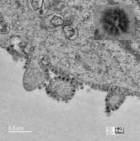 MERS-CoV相关抗原抗体