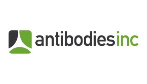 AntibodiesInc新品发布!GFP与谷氨酸受体研究再添利器