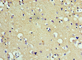 CSB-PA851547ESR1HU IHC