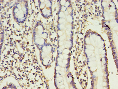 CSB-PA004881EA01HU IHC