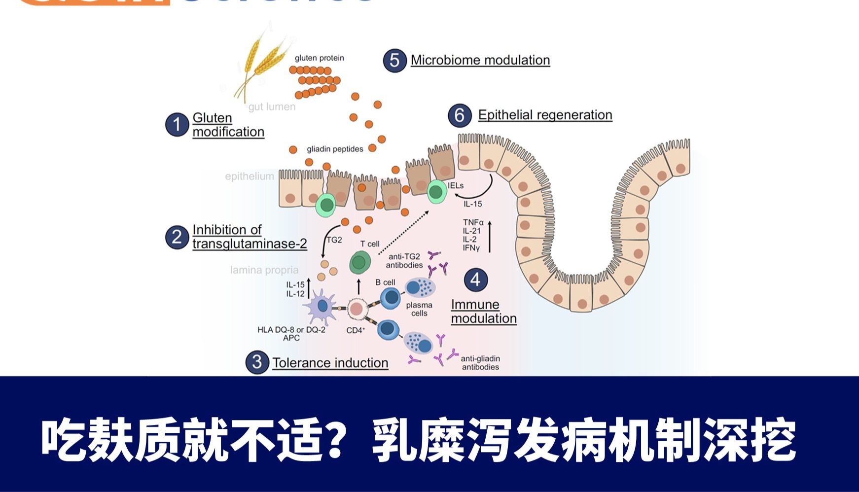 吃麸质就不适？乳糜泻发病机制深挖