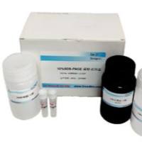 免疫组化通用试剂盒(生物素/链亲合素-HRP系统,针对兔来源一抗),DDM1550A