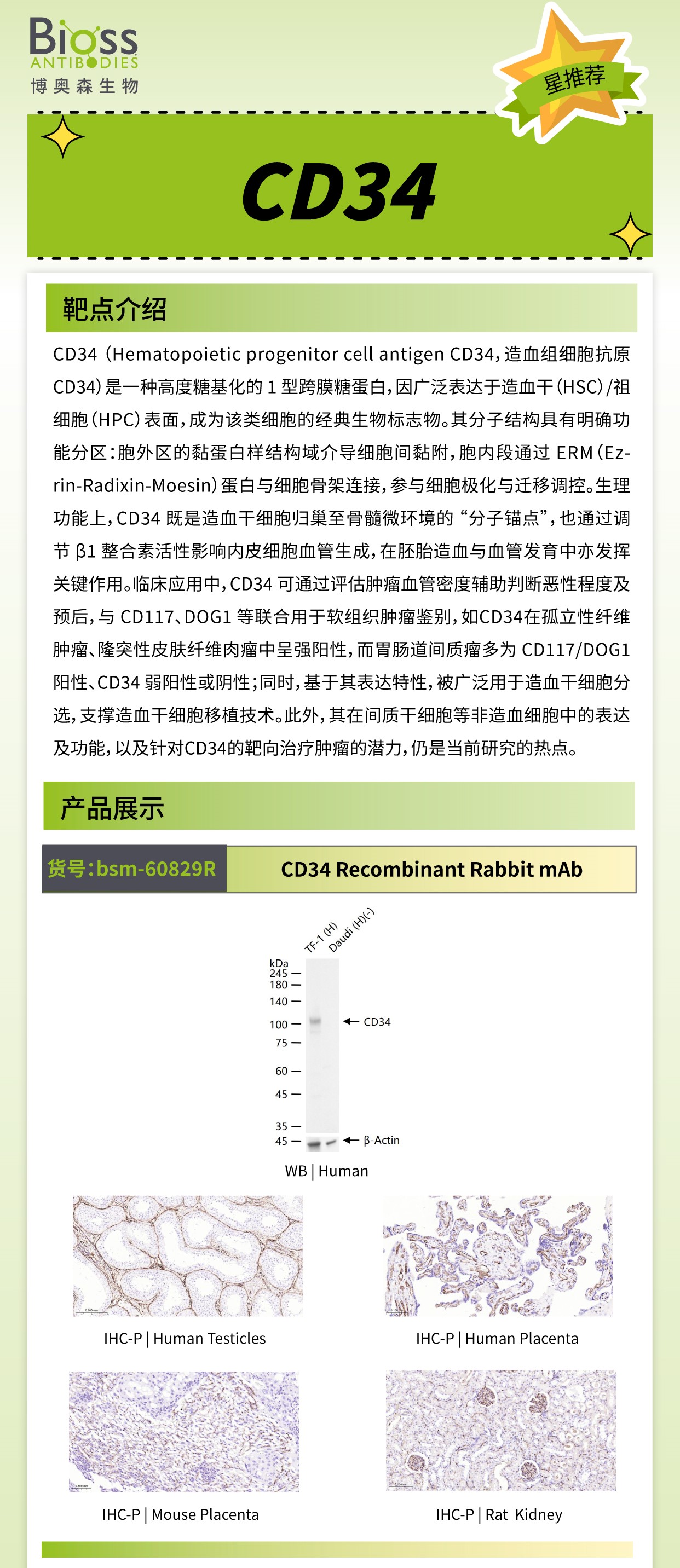 博奥森星推荐 | CD34 抗体