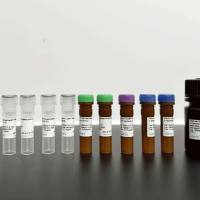 FOXC1 Recombinant Rabbit mAb (S-1607-142)