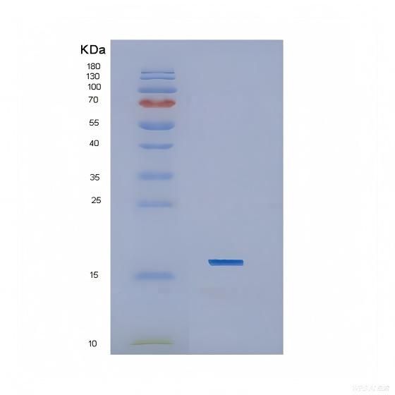 Recombinant Interleukin 1 Beta (IL1b)