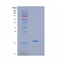 Recombinant Interleukin 1 Beta (IL1b)
