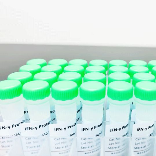 Cathepsin F His Tag Protein, Human