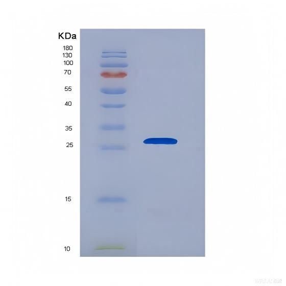 Recombinant Interleukin 29 (IL29)