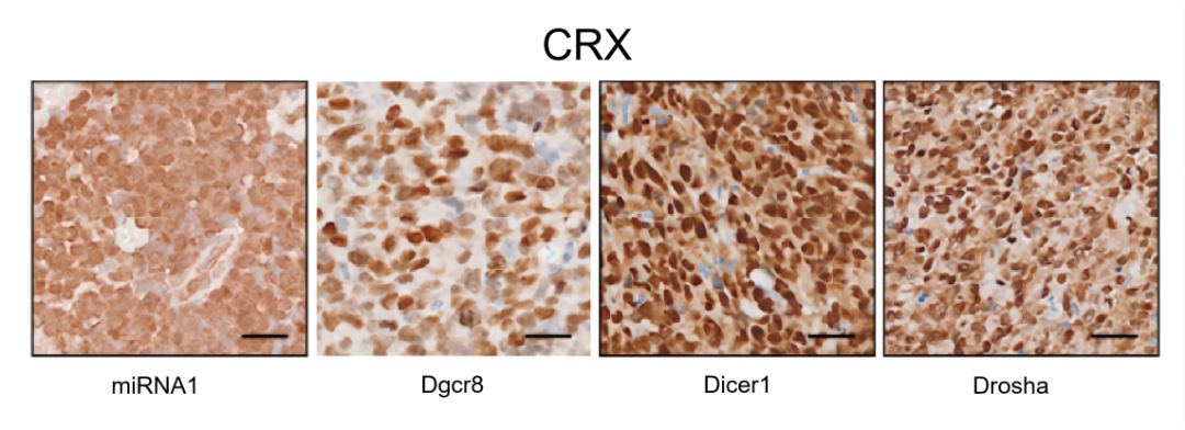 松果体里的秘密：科学家如何破解儿童脑肿瘤的“光之密码”