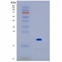 Recombinant Human IL17B Protein (90%)