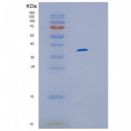 Recombinant Human IL13RA1 Protein产品图