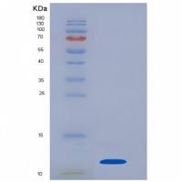 Recombinant Interleukin 8 (IL8)