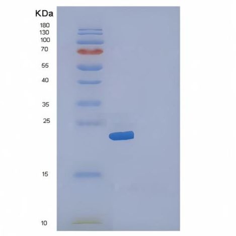 Recombinant Human IL19 / Interleukin-19 Protein (His tag)