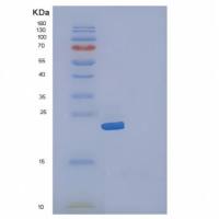 Recombinant Human IL19 / Interleukin-19 Protein (His tag)