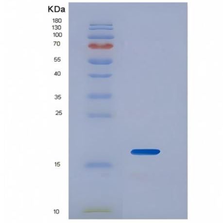 Recombinant Interleukin 2 (IL2)产品图