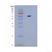 Recombinant Human IL17RB Protein