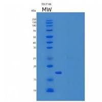 Recombinant Human IL7 / interleukin 7 Protein
