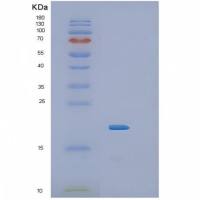 Recombinant Human IL36RN Protein