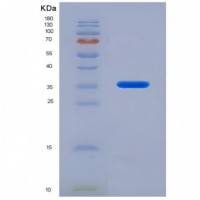 Recombinant Interleukin 21 (IL21)