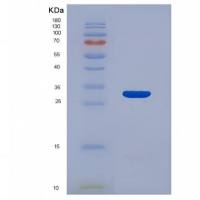 Recombinant Interleukin 22 Receptor Alpha 2 (IL
