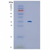 Recombinant Human IL12P40 Protein
