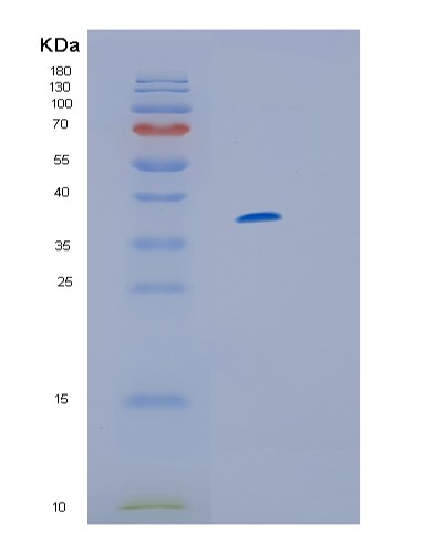 TD-TP02609.jpg