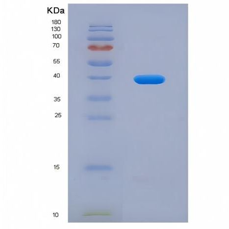 Recombinant Human Interleukin 11 Receptor Alpha (IL11Ra)