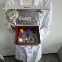 虾（Shrimp）酸性磷酸酶（ACP）ELISA检测试剂盒