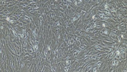 大鼠原代脂肪微血管内皮细胞