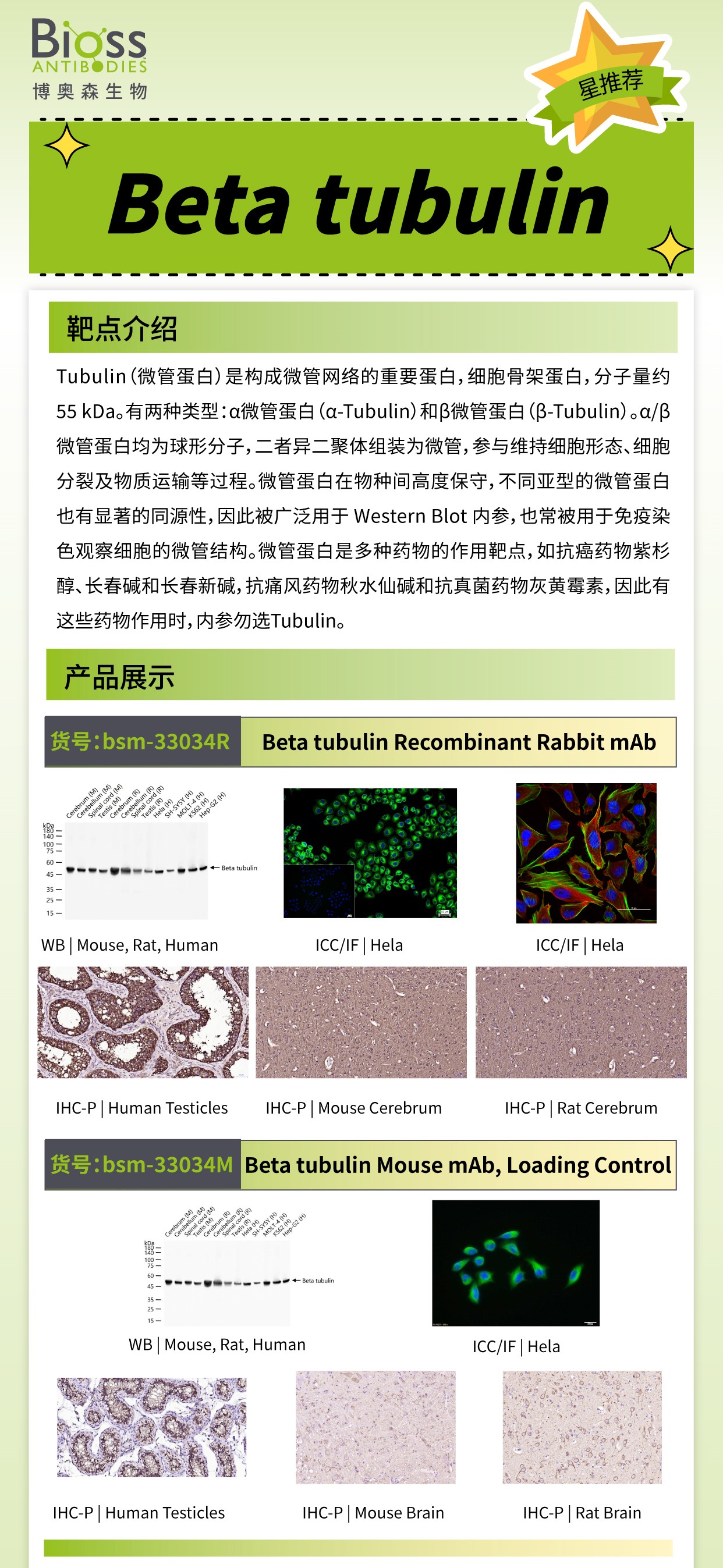 博奥森星推荐 | Beta tubulin 抗体