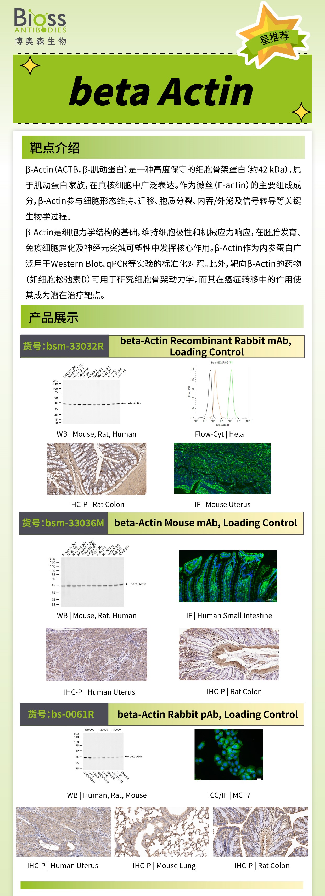 博奥森星推荐 | beta Actin 抗体