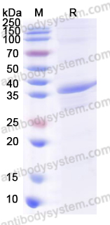 佰乐博生物蛋白抗体——Recombinant Human CXCL14/BRAK/MIP-2G Protein, N-GST重组人CXCL14/BRAK/MIP-2G蛋白，N-GST