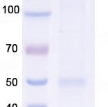 IL6/Interleukin-6活性蛋白, Tag free,Human