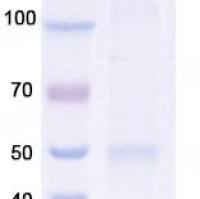 IL4活性蛋白,Tag free,Human