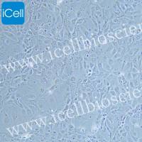 NCI-H3255 人肺腺癌细胞/镜像绮点（Cellverse）