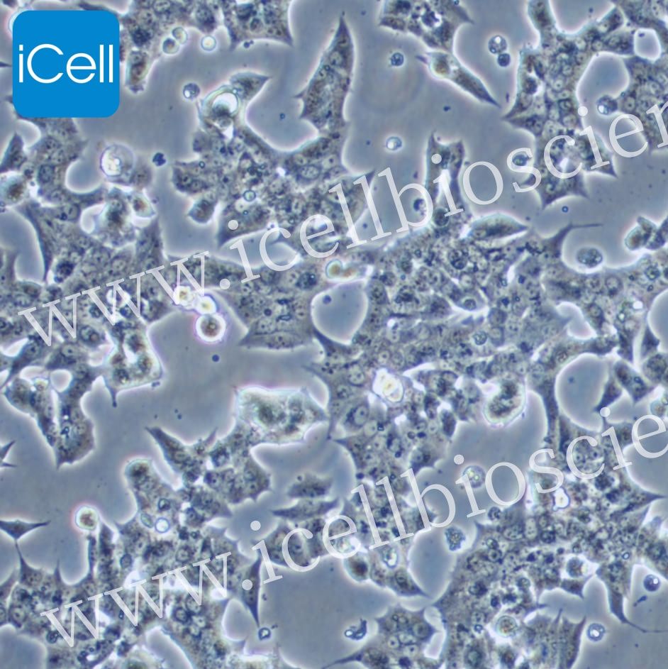 MIN-6细胞/MIN6细胞/小鼠胰岛β细胞系/镜像绮点(Cellverse)产品图