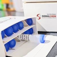 重组EGFR (L858R), 有活性