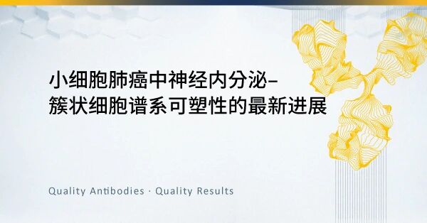 小細胞肺癌中神經內分泌.jpg