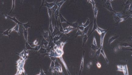 大鼠原代脂肪干细胞