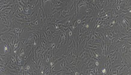 大鼠原代椎体终板软骨细胞技术参数