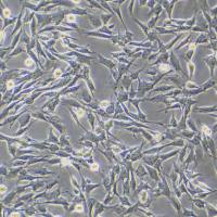 小鼠主动脉平滑肌细胞-永生化