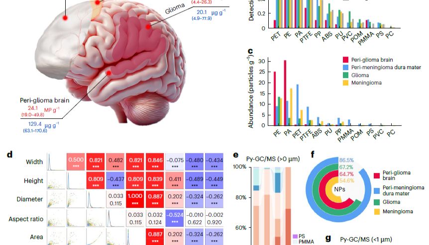 100%发现率！Nature子刊：首次在活人大脑中发现微塑料，或与肿瘤增殖有关