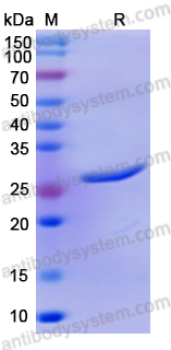 佰乐博生物蛋白抗体------Recombinant Human DDX58/RIG-I Protein, N-His重组人DDX58/RIG-I蛋白（N-His）｜科研实验优选蛋白抗体