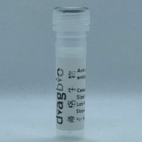beta Actin (DGR18394) Rabbit mAb