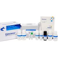 人绒毛膜促性腺激素(HCG)ELISA试剂盒-Human HCG(Chorionic Gonadotropin) ELISA Kit