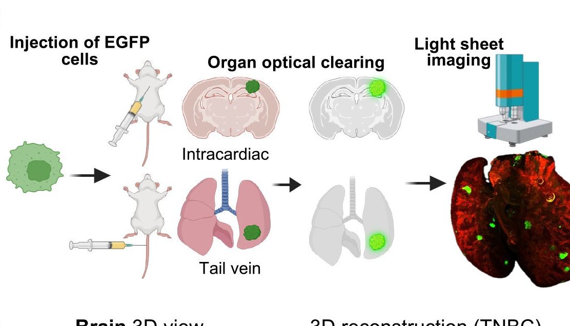 Cell | 破解乳腺癌转移致命蓝图，从分子发现到结构验证