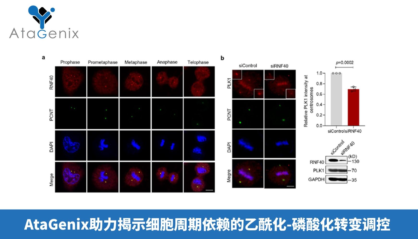 AtaGenix助力揭示细胞周期依赖的乙酰化-磷酸化转变调控中心体成熟机制