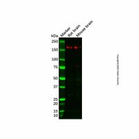 Recombinant ROCK2 Antibody，重组, ExactAb™, 敲低验证, 已验证, 见COA，10μl