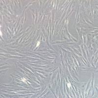 猪肝星状细胞系、猪HSC细胞系、猪HSCs细胞系、永生化猪肝星状细胞、永生化猪HSC细胞、永生化猪HSCs